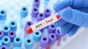Kardeşinden Gelen İlik Hayat Kurtardı: HIV Tarihinde Yeni Dönem